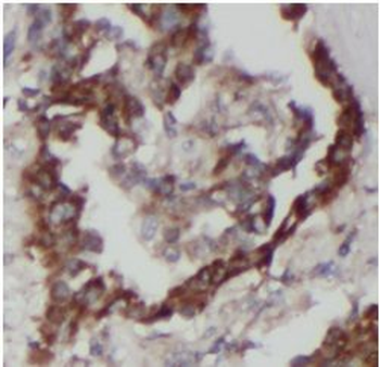 RICTOR Rabbit Polyclonal Antibody