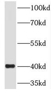 RIMS3 Rabbit Polyclonal Antibody