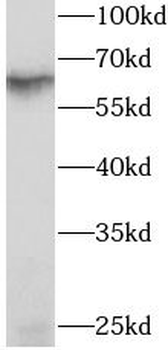 RIOK3 Rabbit Polyclonal Antibody