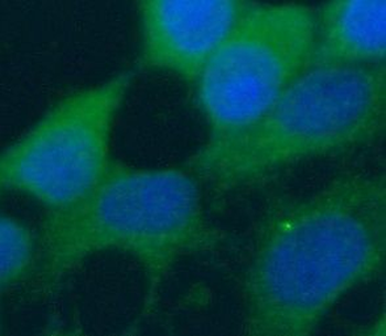 RIOK3 Rabbit Polyclonal Antibody