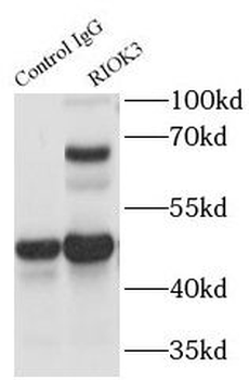 RIOK3 Rabbit Polyclonal Antibody