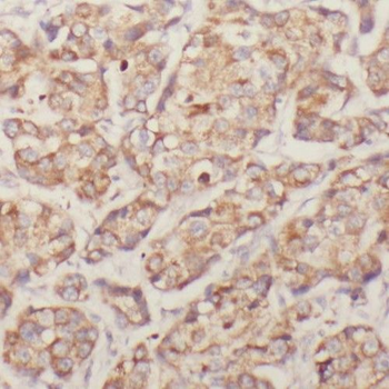 RIOK3 Rabbit Polyclonal Antibody