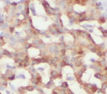 RIPK3 Antibody