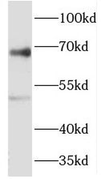 RIPK2 Rabbit Polyclonal Antibody