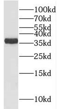 RLBP1 Rabbit Polyclonal Antibody