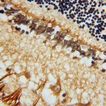 RLBP1 Rabbit Polyclonal Antibody
