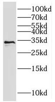 RNASEH2A Rabbit Polyclonal Antibody