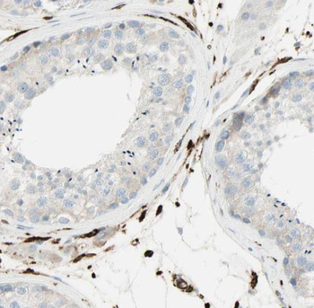 RNASEH2A Rabbit Polyclonal Antibody