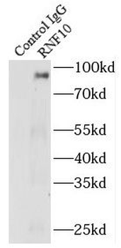 RNF10 Rabbit Polyclonal Antibody
