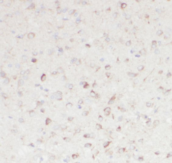 RNF10 Rabbit Polyclonal Antibody