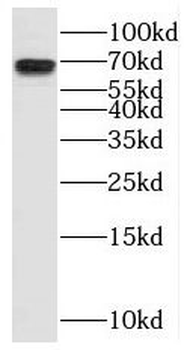RNF112 Rabbit Polyclonal Antibody