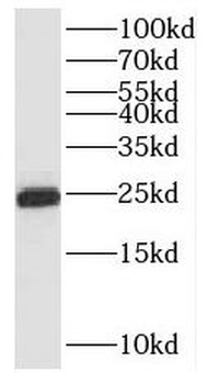 RNF125 Rabbit Polyclonal Antibody