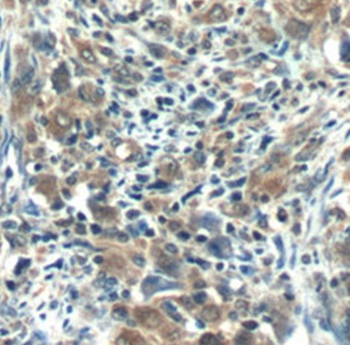 RNF125 Rabbit Polyclonal Antibody