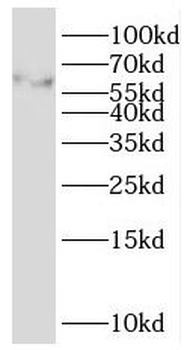MGRN1 Rabbit Polyclonal Antibody