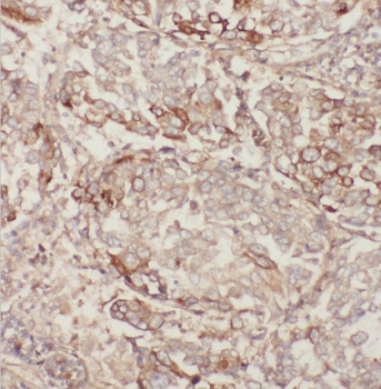 MGRN1 Rabbit Polyclonal Antibody