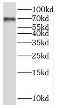 RNF168 Rabbit Polyclonal Antibody