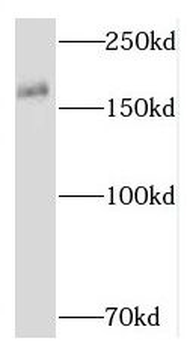 RNF17 Rabbit Polyclonal Antibody