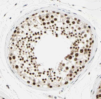 RNF17 Rabbit Polyclonal Antibody