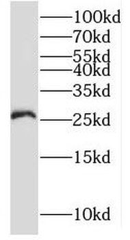 RNF170 Rabbit Polyclonal Antibody