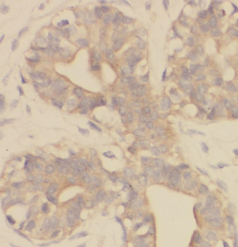RNF170 Rabbit Polyclonal Antibody