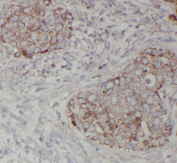 RNF34 Antibody