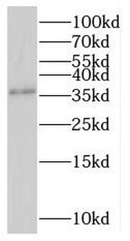 RNF41 Rabbit Polyclonal Antibody