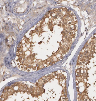 RNF8 Rabbit Polyclonal Antibody