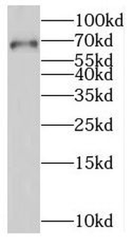 RNGTT Rabbit Polyclonal Antibody