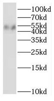 RNH1 Rabbit Polyclonal Antibody