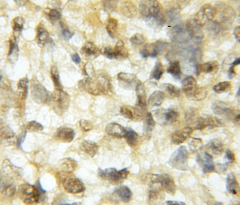 ROBO3 Rabbit Polyclonal Antibody