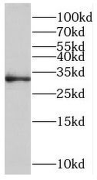 ROGDI Rabbit Polyclonal Antibody