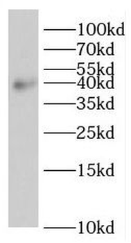 ROM1 Rabbit Polyclonal Antibody