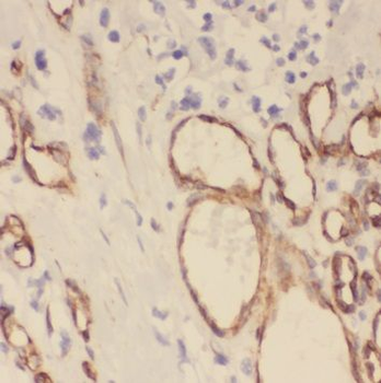ROMO1 Rabbit Polyclonal Antibody