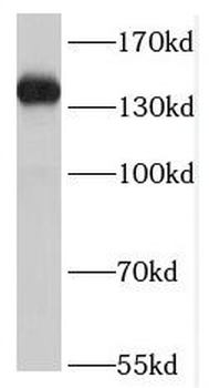 MST1R Rabbit Polyclonal Antibody