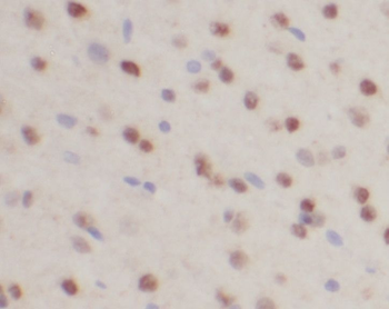 RORB Rabbit Polyclonal Antibody