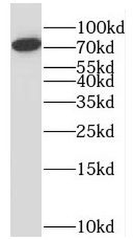 RPAP3 Rabbit Polyclonal Antibody