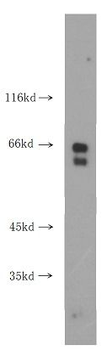 RPE65 Rabbit Polyclonal Antibody