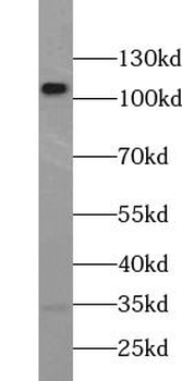 RPGR Rabbit Polyclonal Antibody
