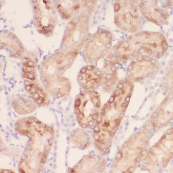 RPGR Rabbit Polyclonal Antibody