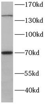 RPGRIP1 Rabbit Polyclonal Antibody