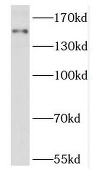 RPGRIP1L Rabbit Polyclonal Antibody