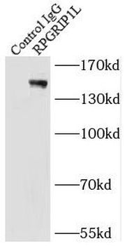 RPGRIP1L Rabbit Polyclonal Antibody