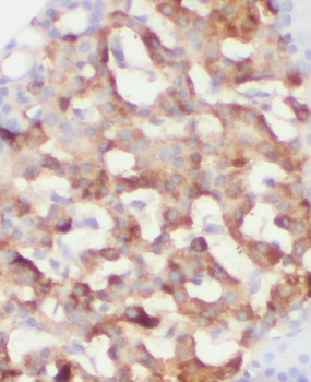 RPGRIP1L Rabbit Polyclonal Antibody