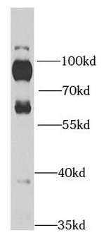 RPH3A Rabbit Polyclonal Antibody