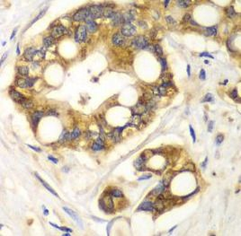 RPH3A Rabbit Polyclonal Antibody