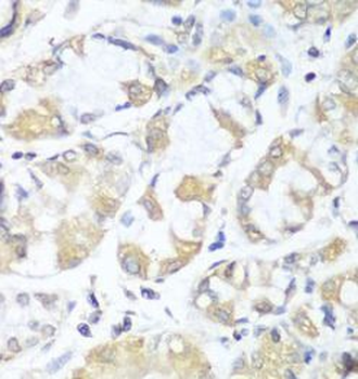RPH3AL Rabbit Polyclonal Antibody