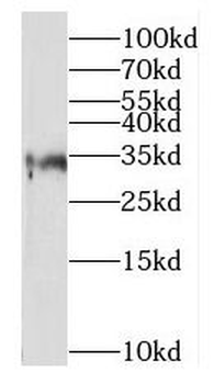 RPIA Rabbit Polyclonal Antibody