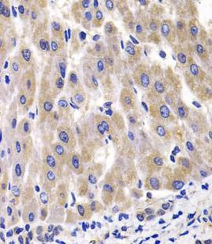 RPL14 Antibody
