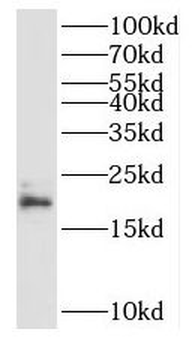 RPL23A Rabbit Polyclonal Antibody