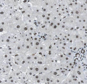 RPL23A Rabbit Polyclonal Antibody